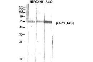 Western Blotting (WB) image for anti-V-Akt Murine Thymoma Viral Oncogene Homolog 1 (AKT1) (pThr450) antibody (ABIN3172849) (AKT1 antibody  (pThr450))