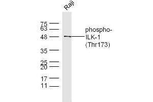 Raji cell lysates probed with Rabbit Anti-ILK-1(Thr173) Polyclonal Antibody, Unconjugated  at 1:500 for 90 min at 37˚C. (ILK antibody  (pThr173))