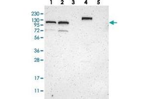 Western blot analysis of Lane 1: RT-4, Lane 2: U-251 MG, Lane 3: Human Plasma, Lane 4: Liver, Lane 5: Tonsil with ZBTB11 polyclonal antibody  at 1:250-1:500 dilution. (ZBTB11 antibody)