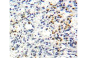 IHC-P analysis of spleen tissue, with DAB staining. (Perforin 1 antibody  (AA 40-355))