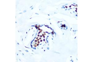 Immunohistochemistry of paraffin-embedded human breast using Phospho-c-Jun-T91 Rabbit mAb (ABIN7268057) at dilution of 1:100 (40x lens). (C-JUN antibody  (pThr91))