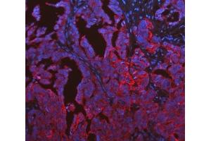 IF analysis of Cytokeratin 19 using anti-Cytokeratin 19 antibody (ABIN3043288). (Cytokeratin 19 antibody  (C-Term))