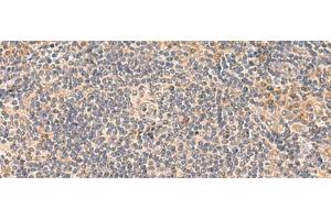 Immunohistochemistry of paraffin-embedded Human tonsil tissue using FUNDC2 Polyclonal Antibody at dilution of 1:50(x200) (FUNDC2 antibody)
