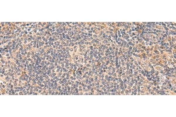 FUNDC2 antibody