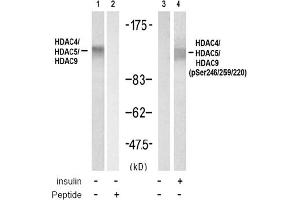 Image no. 1 for anti-HDAC4,HDAC5,HDAC9 (pSer220), (pSer246), (pSer259) antibody (ABIN319279) (HDAC4/HDAC5/HDAC9 antibody  (pSer220, pSer246, pSer259))