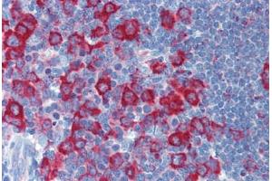 Human Tonsil: Formalin-Fixed, Paraffin-Embedded (FFPE)