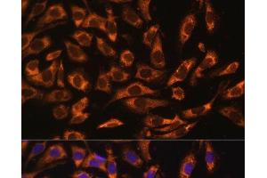 Immunofluorescence analysis of U-2 OS cells using ERK1 / ERK2 Polyclonal Antibody at dilution of 1:100 (40x lens). (ERK1/2 antibody)
