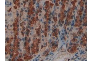 Immunohistochemistry (IHC) image for anti-Leukemia Inhibitory Factor Receptor alpha (LIFR) (AA 382-486) antibody (ABIN7437992)
