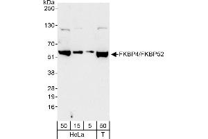 Western Blotting (WB) image for anti-FK506 Binding Protein 4, 59kDa (FKBP4) (AA 400-440) antibody (ABIN7454750)