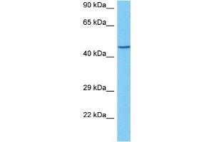 Western Blotting (WB) image for anti-Hydroxysteroid (11-Beta) Dehydrogenase 2 (HSD11B2) (N-Term) antibody (ABIN2776772)