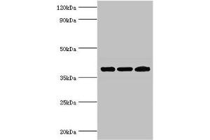 Western blot All lanes: Twinfilin-2 antibody at 3 μg/mL Lane 1: Jurkat whole cell lysate Lane 2: HepG2 whole cell lysate Lane 3: A431 whole cell lysate Secondary Goat polyclonal to rabbit IgG at 1/10000 dilution Predicted band size: 40 kDa Observed band size: 40 kDa (TWF2 antibody  (AA 1-349))