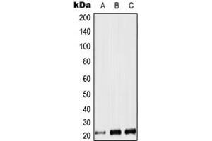 Western blot analysis of LIF expression in Jurkat (A), NIH3T3 (B), PC12 (C) whole cell lysates. (LIF antibody  (Center))