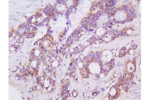 Immunohistochemistry (Paraffin-embedded Sections) (IHC (p)) image for anti-Lectin, Galactoside-Binding, Soluble, 3 Binding Protein (LGALS3BP) (AA 301-400) antibody (ABIN713876)