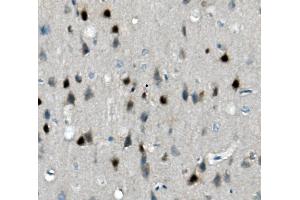 IHC analysis of Calretinin/CALB2 using anti-Calretinin/CALB2 antibody (ABIN7602106). (Calretinin antibody  (AA 59-90))