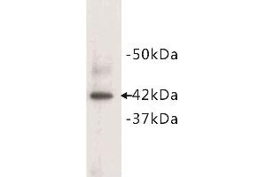 Western blot analysis of mouse heart tissue lysate, using alpha Actin (Cardiac actin) antibody. (ACTC1 antibody  (N-Term))