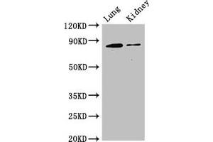 Western Blot Positive WB detected in: Mouse lung tissue, Mouse kidney tissue All lanes: CDH5 antibody at 3 μg/mL Secondary Goat polyclonal to rabbit IgG at 1/50000 dilution Predicted band size: 88, 75 kDa Observed band size: 88 kDa (Cadherin 5 antibody  (AA 349-569))