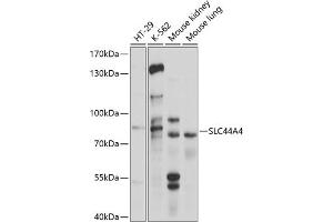 Western blot analysis of extracts of various cell lines, using SLC44 antibody (ABIN6130964, ABIN6148004, ABIN6148005 and ABIN6214687) at 1:1000 dilution. (SLC44A4 antibody  (AA 65-215))