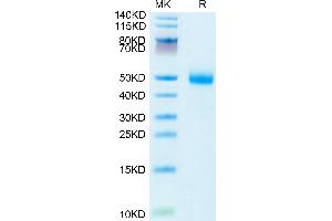 Human ST3GAL4 on Tris-Bis PAGE under reduced condition. (ST3GAL4 Protein (AA 41-333) (HA tag,His tag))