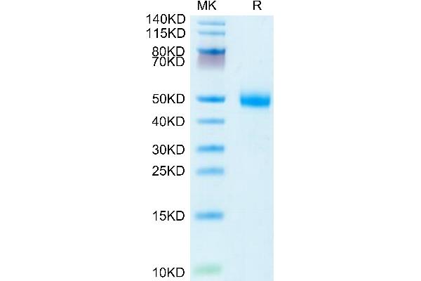 ST3GAL4 Protein (AA 41-333) (HA tag,His tag)