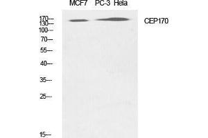 Western Blotting (WB) image for anti-Centrosomal Protein 170kDa (CEP170) (Internal Region) antibody (ABIN3183859)