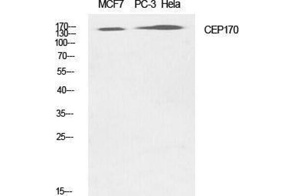 CEP170 抗体  (Internal Region)