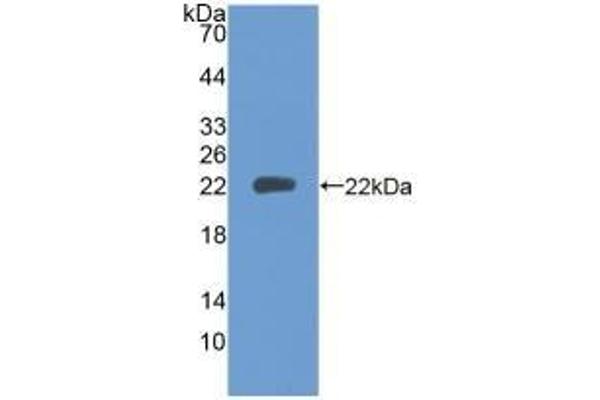 PTPRN antibody  (AA 35-185)