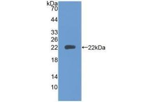 PTPRN anticorps  (AA 35-185)