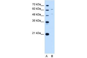 UGT1A4 antibody used at 1 ug/ml to detect target protein. (UGT1A4 antibody  (N-Term))