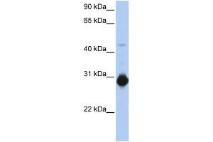 WB Suggested Anti-RHOU Antibody Titration:  0. (RHOU antibody  (C-Term))