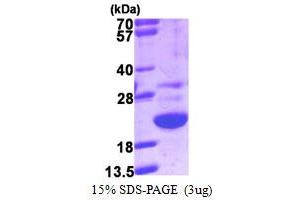 SDS-PAGE (SDS) image for Galectin-Related Protein (GRP) (AA 1-172) protein (His tag) (ABIN667551) (GRP Protein (AA 1-172) (His tag))