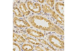 Immunohistochemistry of paraffin-embedded human kidney using CDC42 antibody at dilution of 1:200 (x400 lens)