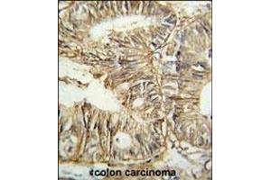 Immunohistochemistry (Paraffin-embedded Sections) (IHC (p)) image for anti-Glycoprotein A33 (Transmembrane) (GPA33) (AA 264-293), (C-Term) antibody (ABIN652835)