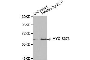 Western blot analysis of extracts from A431 cells using Phospho-MYC-S373 antibody (ABIN2987392). (c-MYC antibody  (pSer373))