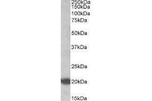 Western Blotting (WB) image for anti-GTPase NRas (NRAS) (Internal Region) antibody (ABIN302138)