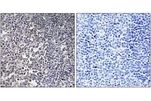 Immunohistochemistry analysis of paraffin-embedded human tonsil tissue, using MRPS16 Antibody. (MRPS16 antibody  (AA 81-130))
