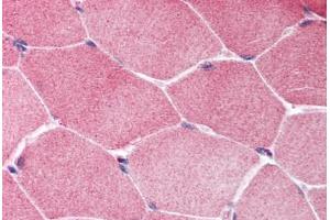 Human Skeletal Muscle (formalin-fixed, paraffin-embedded) stained with TSC1 antibody ABIN214014 at 5 ug/ml followed by biotinylated goat anti-rabbit IgG secondary antibody ABIN481713, alkaline phosphatase-streptavidin and chromogen. (TSC1 antibody  (C-Term))
