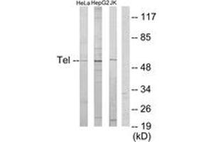 Western blot analysis of extracts from HeLa/HepG2/Jurkat cells, using ETV6 Antibody. (ETV6 antibody  (AA 371-420))