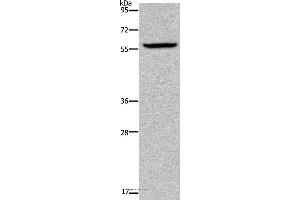 Western blot analysis of Human fetal brain tissue, using KDM4D Polyclonal Antibody at dilution of 1:1100 (JMJD2D antibody)