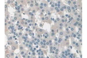 Immunohistochemistry (IHC) image for anti-Coenzyme Q6, Monooxygenase (COQ6) (AA 1-476) antibody (ABIN5013359)