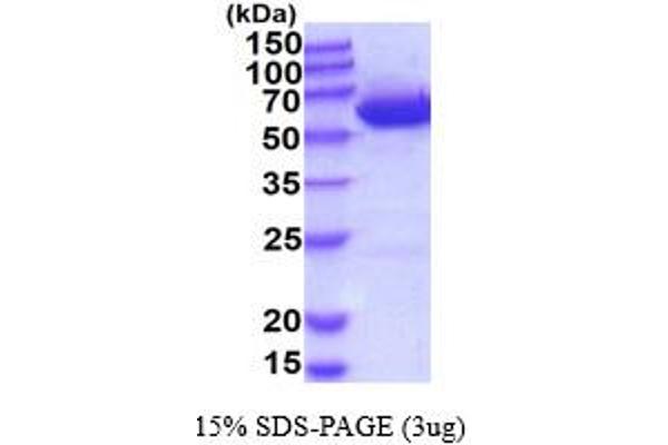 UGDH Protein (AA 1-494) (His tag)