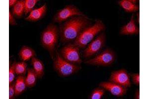 Immunofluorescence (IF) image for anti-alpha Tubulin (TUBA1) antibody (Alexa Fluor 594) (ABIN2656867) (alpha Tubulin antibody  (Alexa Fluor 594))