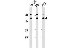 Western Blotting (WB) image for anti-Acetylcholinesterase (AChE) antibody (ABIN3003530) (Acetylcholinesterase antibody)