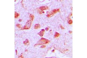 Immunohistochemical analysis of Praja2 staining in human brain formalin fixed paraffin embedded tissue section. (PJA2 antibody  (Center))