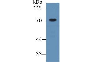 Detection of a1BG in Human Serum using Monoclonal Antibody to Alpha-1-B-Glycoprotein (a1BG) (A1BG antibody  (AA 22-206))