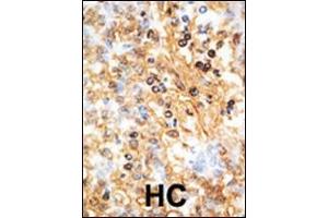 Immunohistochemistry (Paraffin-embedded Sections) (IHC (p)) image for anti-Docking Protein 1, 62kDa (Downstream of tyrosine Kinase 1) (DOK1) (AA 9-39), (N-Term) antibody (ABIN392070)