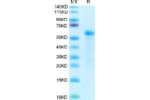 Cynomolgus DLL3 on Tris-Bis PAGE under reduced condition. (DLL3 Protein (AA 27-477) (His tag))