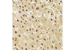 Immunohistochemistry (Paraffin-embedded Sections) (IHC (p)) image for anti-Acidic (Leucine-Rich) Nuclear phosphoprotein 32 Family, Member A (ANP32A) (AA 1-170) antibody (ABIN6136909)