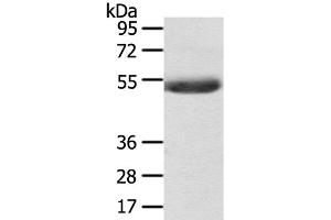 Western Blot analysis of Mouse plasma tissue using AGPAT6 Polyclonal Antibody at dilution of 1:400 (AGPAT6 antibody)