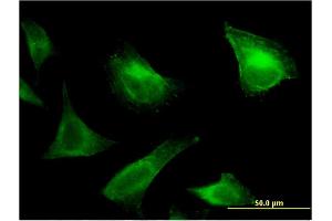 Immunofluorescence of monoclonal antibody to PRRG1 on HeLa cell. (PRRG1 antibody  (AA 22-81))
