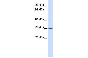 WB Suggested Anti-VTI1A Antibody Titration: 0. (VTI1A antibody  (N-Term))